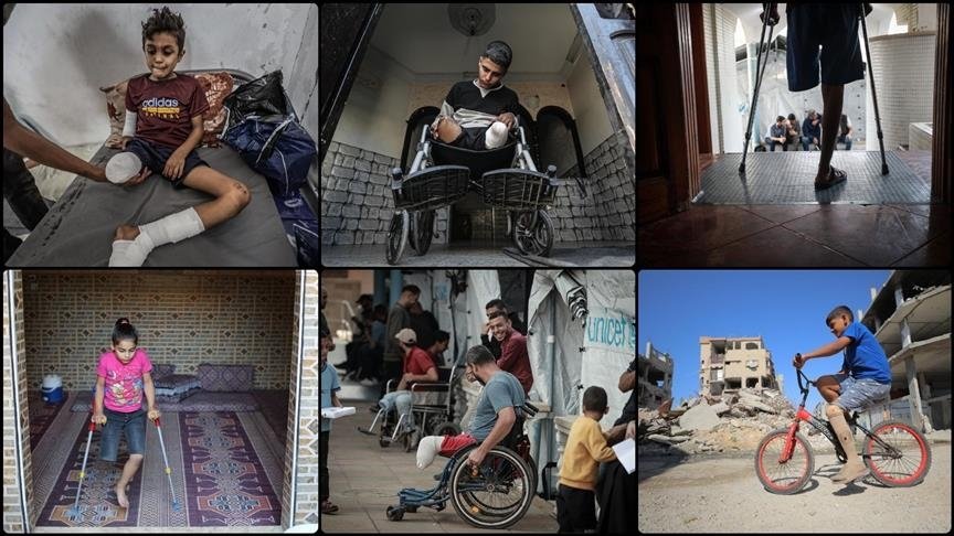 Ministria e Shëndetësisë në Gaza  6 000 persona të amputuar kanë nevojë për rehabilitim urgjent
