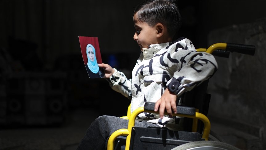 Shtatëvjeçari i paralizuar nga një sulm izraelit lufton për t u rikuperuar në Gaza