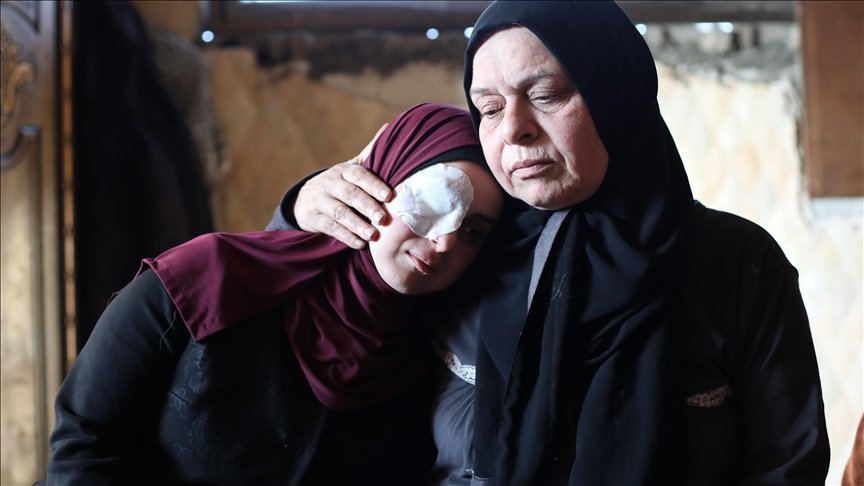  FOTO  Humbi syrin në sulmin izraelit  e reja nga Gaza vazhdon të pikturojë pavarësisht aftësisë së kufizuar