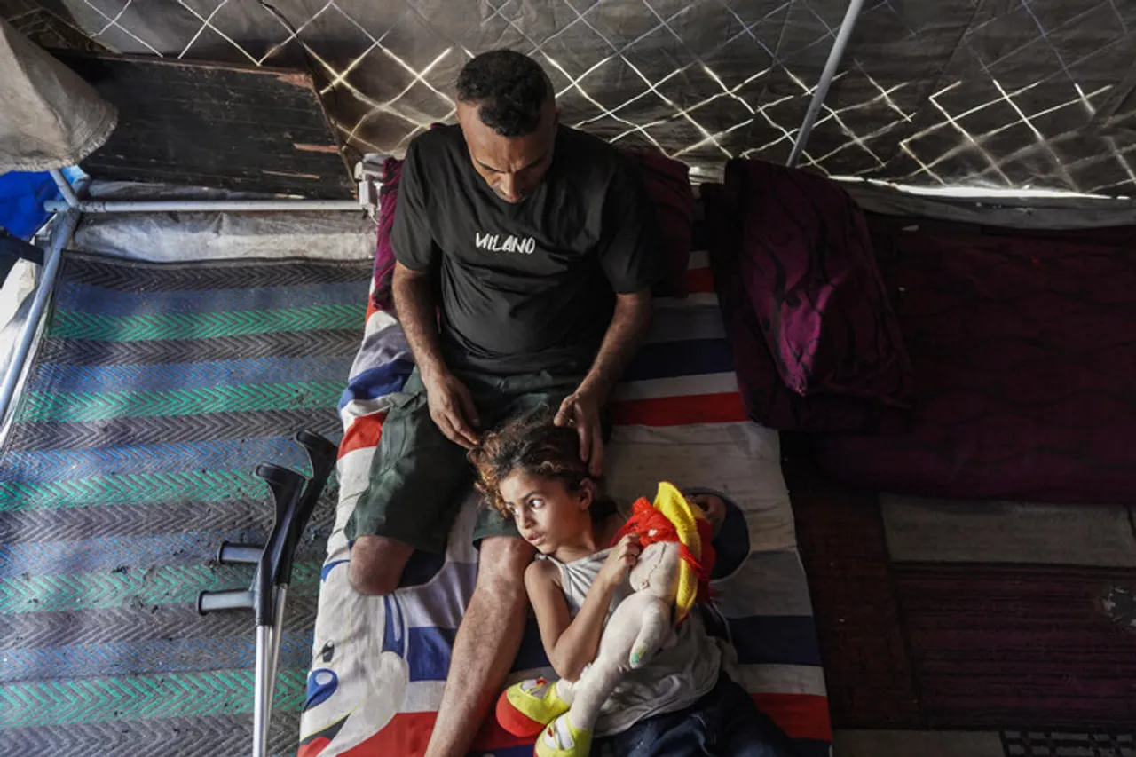 OBSh ja  43 000 njerëz në Gaza kanë pësuar lëndime që ua kanë ndryshuar jetën që nga viti 2023