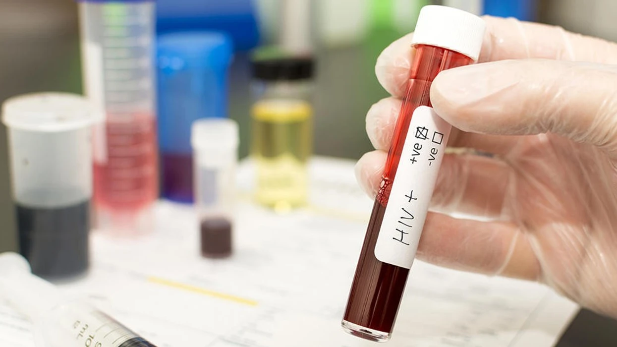 Në korrik janë regjistruar 11 raste të reja me HIV AIDS  më i riu është 20 vjeç